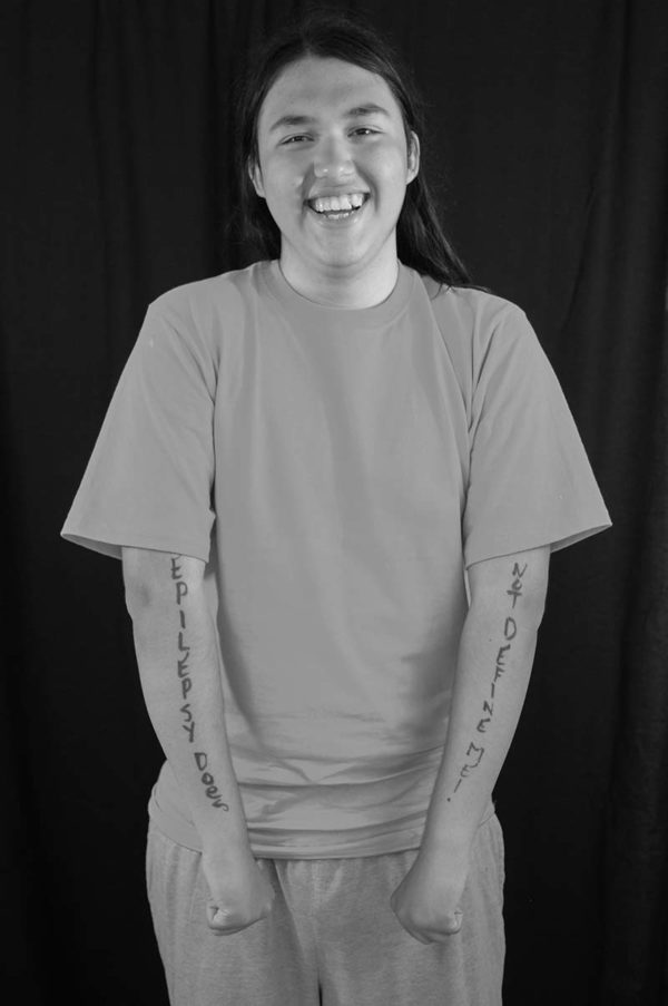 Epilepsy Does Not Define Me